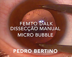 Dr. Pedro Bertino Oftalmologia